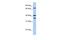 Transglutaminase 5 antibody, PA5-43311, Invitrogen Antibodies, Western Blot image 