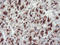 Golgi Membrane Protein 1 antibody, LS-C173675, Lifespan Biosciences, Immunohistochemistry paraffin image 