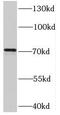 Synoviolin 1 antibody, FNab08463, FineTest, Western Blot image 