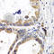 Fatty Acid Binding Protein 3 antibody, A5312, ABclonal Technology, Immunohistochemistry paraffin image 