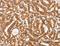 Interferon-inducible protein AIM2 antibody, LS-C401421, Lifespan Biosciences, Immunohistochemistry paraffin image 