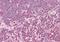 Rho Associated Coiled-Coil Containing Protein Kinase 1 antibody, orb96202, Biorbyt, Immunohistochemistry paraffin image 