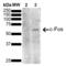 Fos Proto-Oncogene, AP-1 Transcription Factor Subunit antibody, LS-C776589, Lifespan Biosciences, Western Blot image 