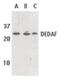 RING1 And YY1 Binding Protein antibody, PA5-19943, Invitrogen Antibodies, Western Blot image 