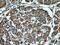Superoxide Dismutase 2 antibody, 66474-1-Ig, Proteintech Group, Immunohistochemistry paraffin image 