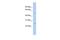 Tetratricopeptide Repeat Domain 8 antibody, PA5-43307, Invitrogen Antibodies, Western Blot image 