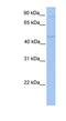 Transmembrane And Tetratricopeptide Repeat Containing 2 antibody, NBP1-62592, Novus Biologicals, Western Blot image 