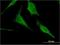 Hexosaminidase Subunit Alpha antibody, H00003073-M06, Novus Biologicals, Immunofluorescence image 