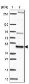 NFS1 Cysteine Desulfurase antibody, NBP2-38737, Novus Biologicals, Western Blot image 