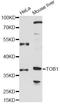 Transducer Of ERBB2, 1 antibody, LS-C749815, Lifespan Biosciences, Western Blot image 