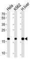 Mitochondrial Pyruvate Carrier 1 antibody, MBS9211639, MyBioSource, Western Blot image 