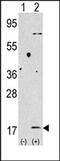 Microtubule Associated Protein 1 Light Chain 3 Beta antibody, MBS9210689, MyBioSource, Western Blot image 