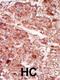 Hexokinase 3 antibody, 63-420, ProSci, Immunohistochemistry paraffin image 