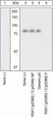 Ribosomal Protein S6 Kinase A1 antibody, GTX10697, GeneTex, Western Blot image 