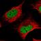 Zinc Finger Protein 470 antibody, HPA029000, Atlas Antibodies, Immunofluorescence image 