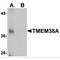 Transmembrane Protein 38A antibody, MBS150362, MyBioSource, Western Blot image 