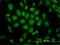 Tubulin Beta 4B Class IVb antibody, H00010383-M02, Novus Biologicals, Immunocytochemistry image 