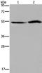 Solute Carrier Family 22 Member 12 antibody, PA5-50717, Invitrogen Antibodies, Western Blot image 