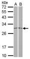 Mitochondrial Ribosomal Protein L19 antibody, LS-C155559, Lifespan Biosciences, Western Blot image 
