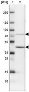 Transforming Growth Factor Beta Induced antibody, NBP1-88606, Novus Biologicals, Western Blot image 