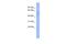 Twinfilin Actin Binding Protein 1 antibody, A07004, Boster Biological Technology, Western Blot image 