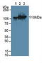 Hexokinase 3 antibody, LS-C294499, Lifespan Biosciences, Western Blot image 