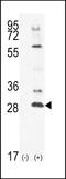 Testis Specific Serine Kinase 4 antibody, MBS9212236, MyBioSource, Western Blot image 