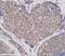 Matrix Metallopeptidase 2 antibody, NB200-113, Novus Biologicals, Immunohistochemistry frozen image 