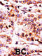 Pantothenate kinase 1 antibody, abx033205, Abbexa, Immunohistochemistry frozen image 