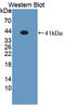 Nuclear Receptor Subfamily 1 Group H Member 3 antibody, LS-C374316, Lifespan Biosciences, Western Blot image 