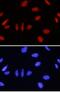 Inhibitor of growth protein 1 antibody, PA5-47772, Invitrogen Antibodies, Immunocytochemistry image 