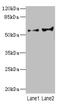 Cytochrome P450 Family 2 Subfamily C Member 18 antibody, LS-C675611, Lifespan Biosciences, Western Blot image 
