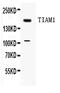 T Cell Lymphoma Invasion And Metastasis 1 antibody, PA5-80130, Invitrogen Antibodies, Western Blot image 