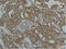 Heat Shock Protein Family A (Hsp70) Member 8 antibody, GTX33999, GeneTex, Immunohistochemistry paraffin image 