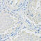 Solute carrier family 2, facilitated glucose transporter member 9 antibody, 15-626, ProSci, Immunohistochemistry frozen image 