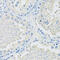 Solute Carrier Family 2 Member 9 antibody, 15-626, ProSci, Immunohistochemistry frozen image 