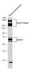 Solute Carrier Family 1 Member 3 antibody, GTX134059, GeneTex, Western Blot image 