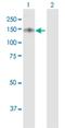 Ubiquitin Specific Peptidase 19 antibody, H00010869-B01P, Novus Biologicals, Western Blot image 