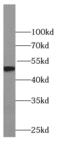 Tyrosyl-DNA Phosphodiesterase 2 antibody, FNab09098, FineTest, Western Blot image 