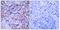 3-Phosphoinositide Dependent Protein Kinase 1 antibody, A01159, Boster Biological Technology, Immunohistochemistry frozen image 