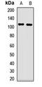 Transient Receptor Potential Cation Channel Subfamily C Member 6 antibody, orb412685, Biorbyt, Western Blot image 
