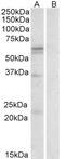 Solute Carrier Family 7 Member 5 antibody, EB09262, Everest Biotech, Western Blot image 