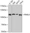 Piwi Like RNA-Mediated Gene Silencing 4 antibody, 18-960, ProSci, Western Blot image 