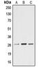 Ephrin A4 antibody, GTX55144, GeneTex, Western Blot image 