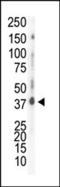 Casein Kinase 1 Delta antibody, 62-884, ProSci, Western Blot image 