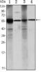 Aldehyde Dehydrogenase 1 Family Member A1 antibody, GTX82775, GeneTex, Western Blot image 