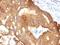 Keratin 8 antibody, M01421, Boster Biological Technology, Immunohistochemistry paraffin image 