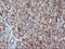 Mitogen-Activated Protein Kinase Kinase 3 antibody, LS-C174452, Lifespan Biosciences, Immunohistochemistry paraffin image 