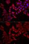 Caspase 14 antibody, GTX33063, GeneTex, Immunocytochemistry image 