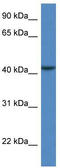 Calcium-binding protein 39-like antibody, TA343048, Origene, Western Blot image 